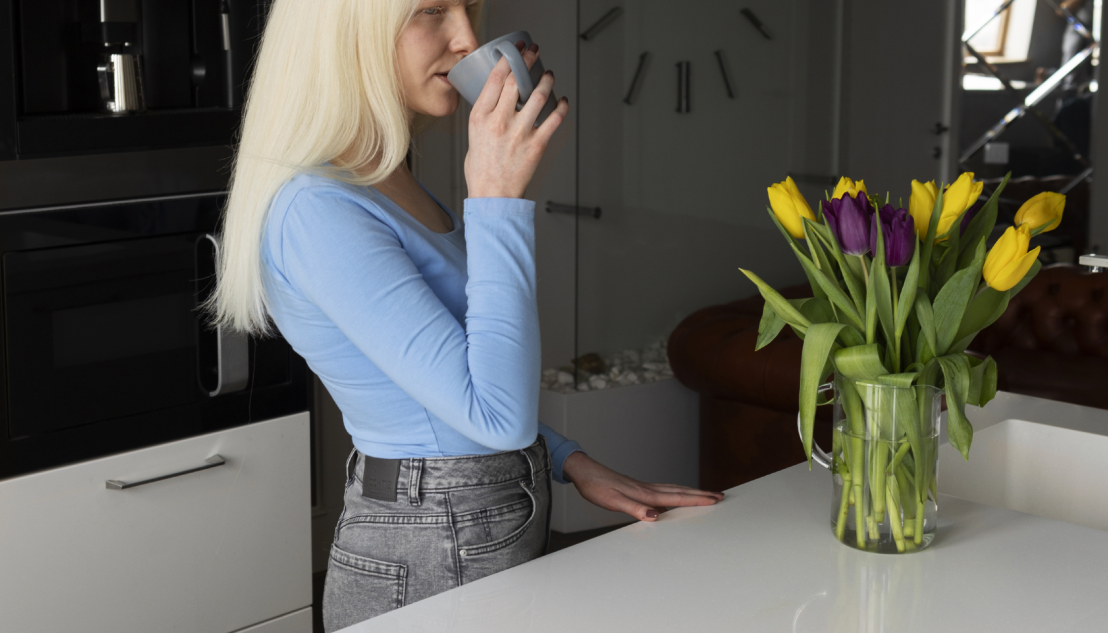 young-woman-with-albinism-spending-time-home